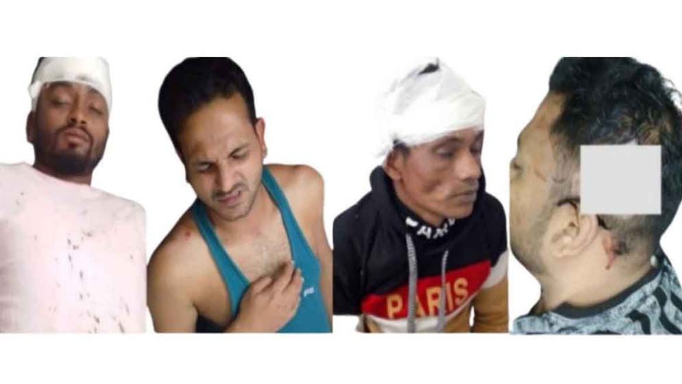 চট্টগ্রামে বিএনপি-জামায়াত সংঘর্ষ, আহত ১৬