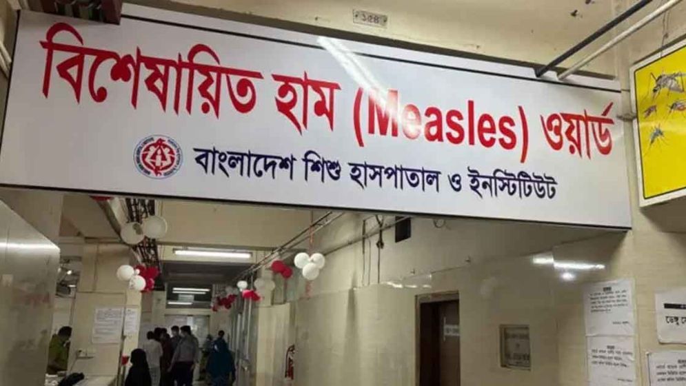 হাম ও উপসর্গে ২৪ ঘণ্টায় ১১ শিশুর মৃত্যু, আক্রান্ত ১৩১৫
