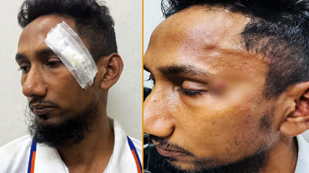 ব্যানার সরানো নিয়ে কবি নজরুল কলেজের ইলেকট্রিশিয়ানকে মারধরের অভিযোগ