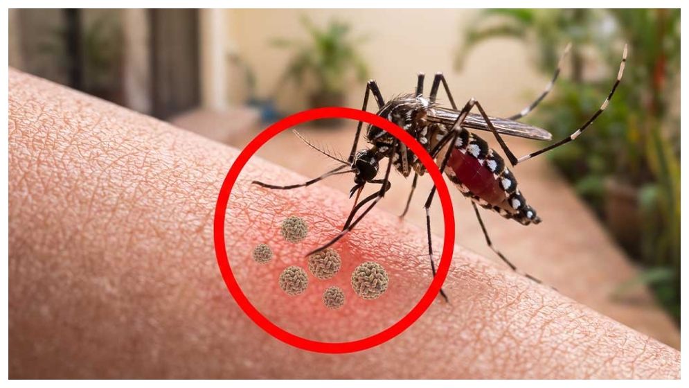 ডেঙ্গু আতঙ্ক কাটছে না, ২৫০ মৃত্যুতে উদ্বেগ