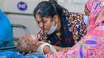 হামের উপসর্গ নিয়ে আরও তিন শিশুর মৃত্যু, হাসপাতালে ভর্তি ১,৩৪৯ শিশু