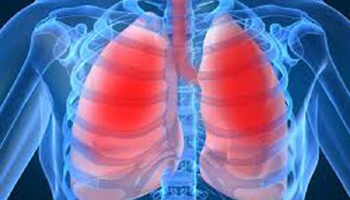 High levels of insulin affect lungs, says study