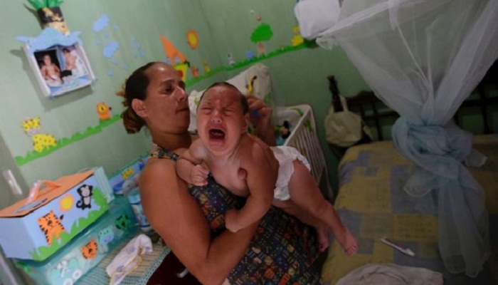 US health experts confirm that Zika causes birth defects