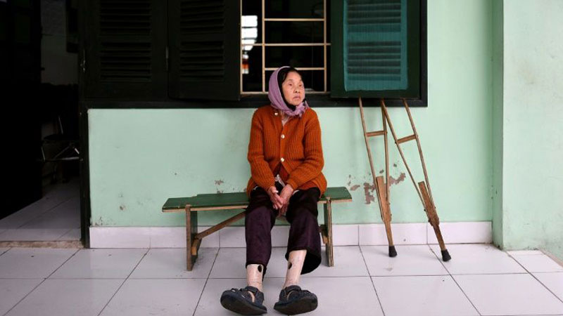 Life after leprosy in Vietnam