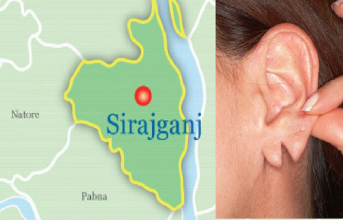 Upazila chairman sued for assaulting female UP member