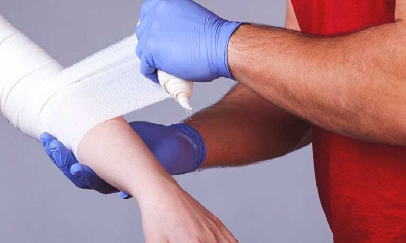 First aid tips: How to help a person with burn injuries