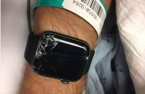 Apple Watch saves biker’s life after detecting fall