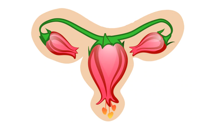 Everything you need to know about PCOS