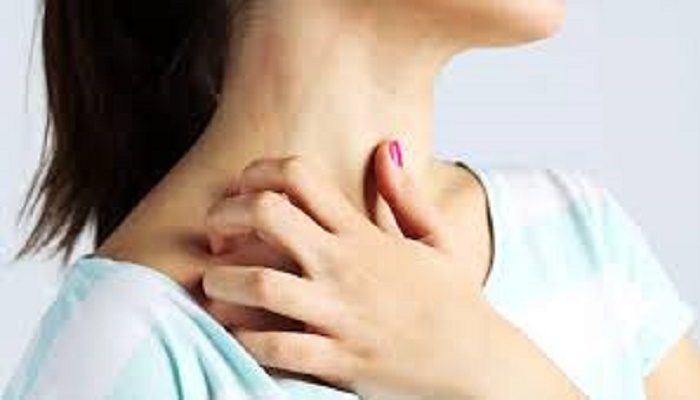  Find out what could be causing of itchy