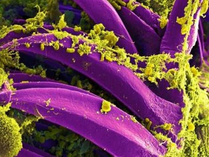 Two people just got black death plague in China