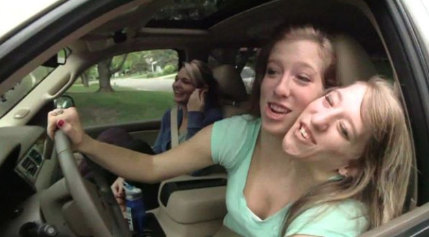World's most famous conjoined twins on dating, learning to drive and playing