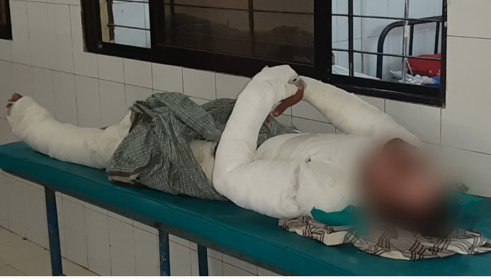 5 hurt in gas cylinder blast in Chattogram