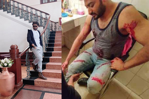 Actor Bappy injured during shooting at BFDC