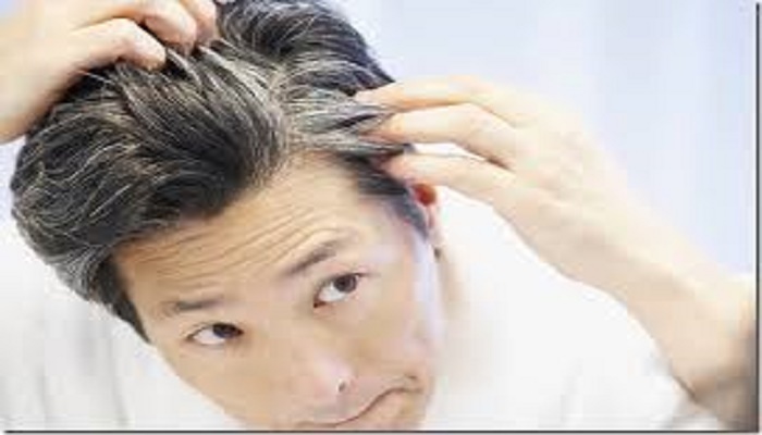 Causes of premature greying of hair