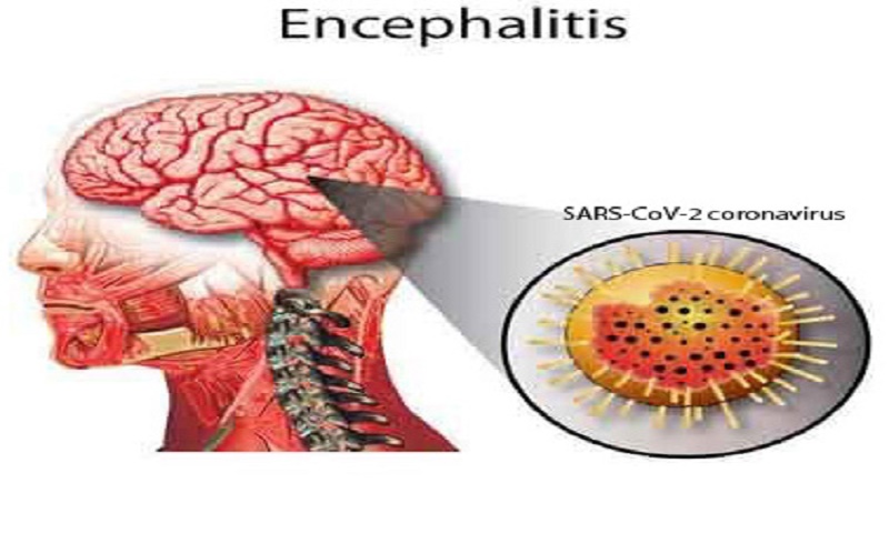 Coronavirus: Some patients show signs of brain ailments