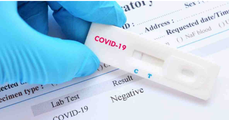 8 Rohingyas among 36 fresh Covid-19 patients in Cox’s Bazar