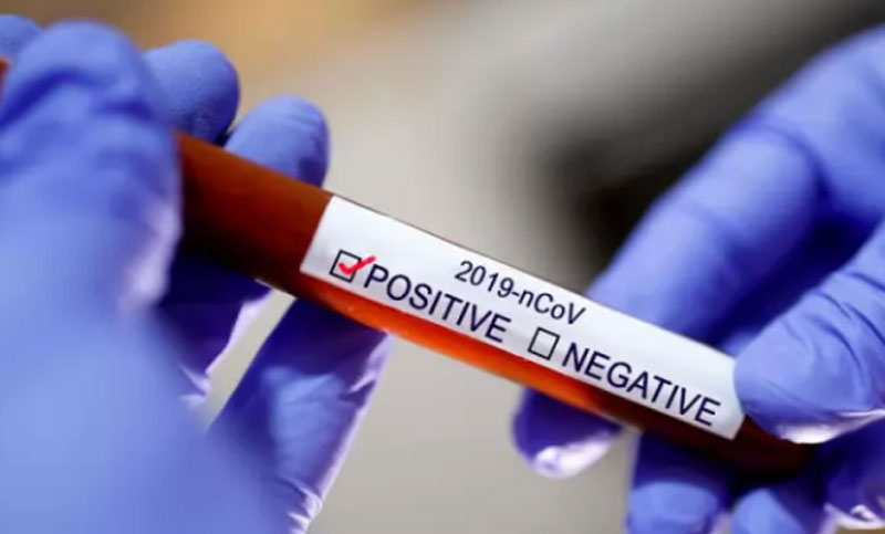 166 more test coronavirus positive in Chattogram 