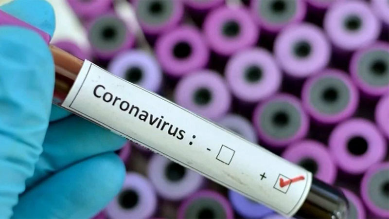 100 more infected with COVID-19 in Ctg