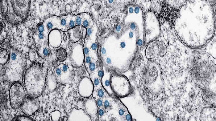 Covid-19 reinfection possibility seems slim: WHO
