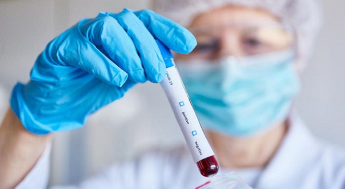 COVID-19 death toll unacceptably high: WHO