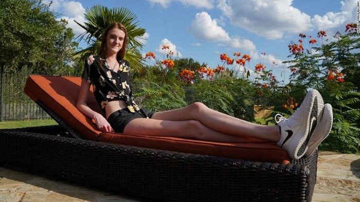 A Texas teenager breaks two world records for longest legs