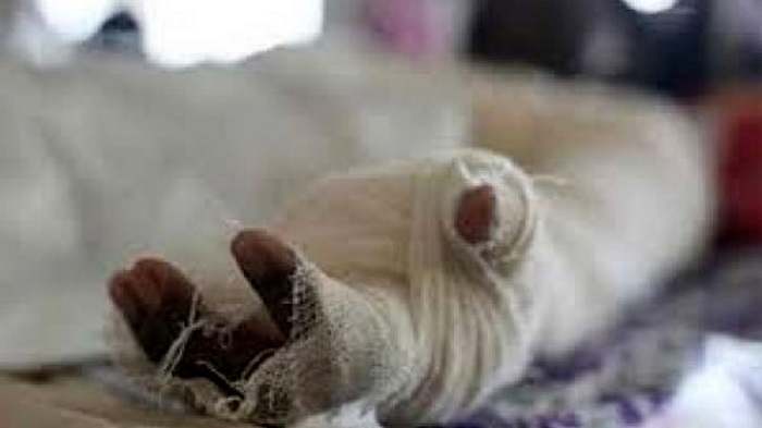 Three of a family burnt in Narayanganj fire 