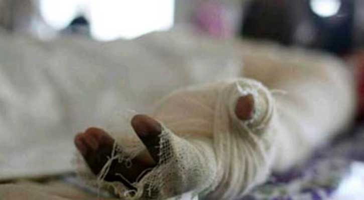 4 security guards burnt in Narayanganj paper mill fire