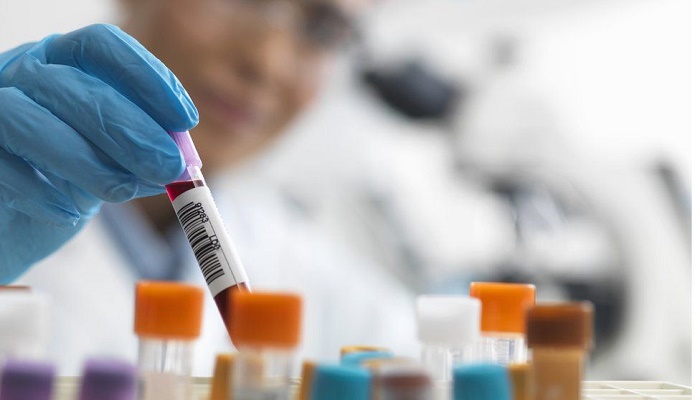 Extra blood test could help spot heart-attack death risk