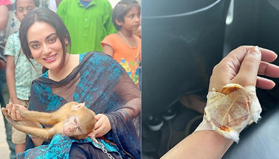 Actress Toma Mirza injured after monkey bite