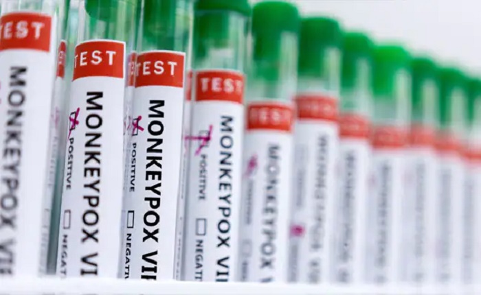 Monkeypox in non-endemic countries suggests undetected transmission: WHO