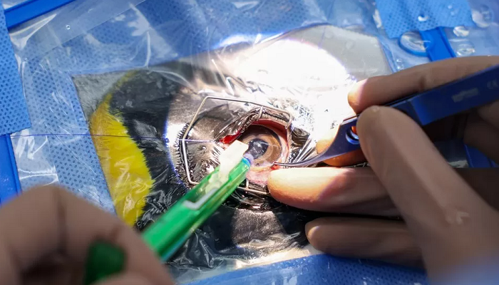 Singapore: The penguins given world-first cataract surgery