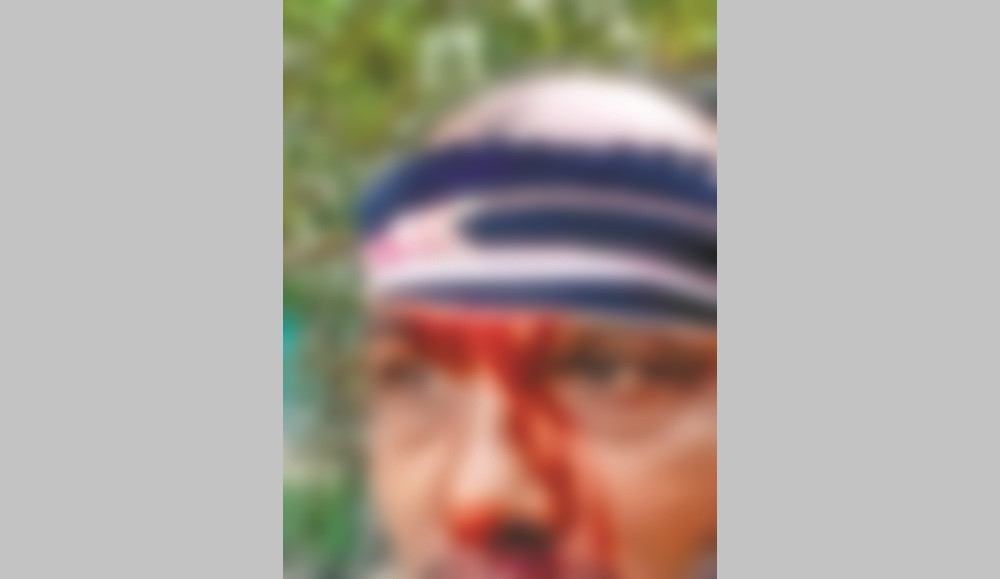 6 suffer bullet wounds as Rafiq’s goons attack Nawra village again