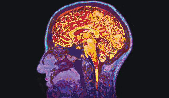 Middle-aged Brain Changes a Lot – and It Is Key to Understanding Dementia