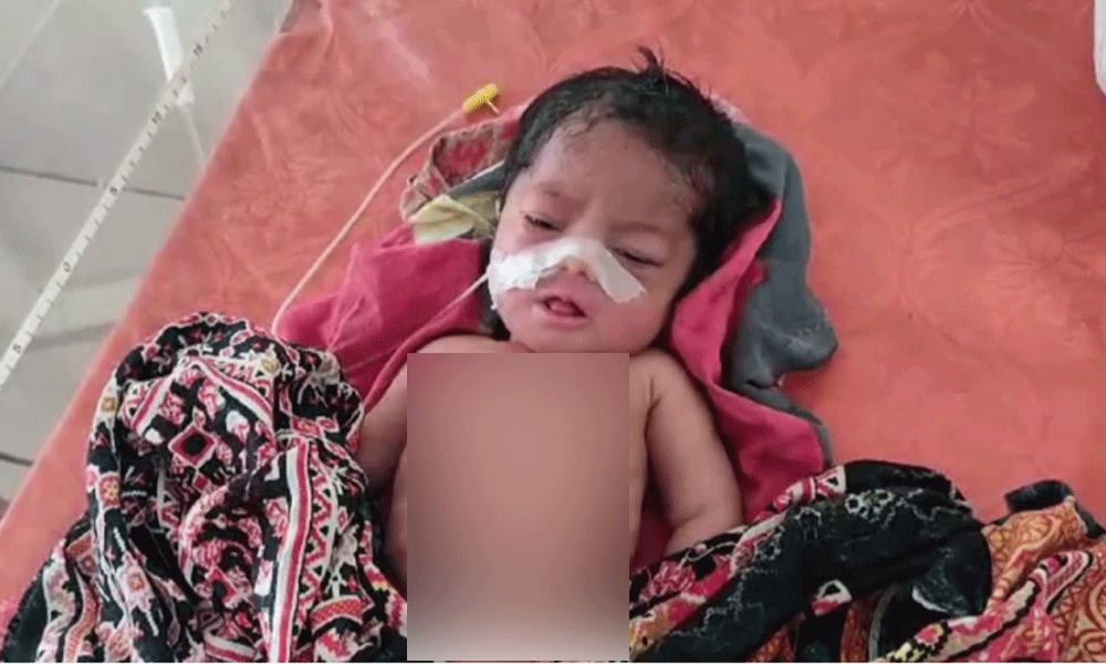 Newborn's abdomen cut during C-section at Faridpur