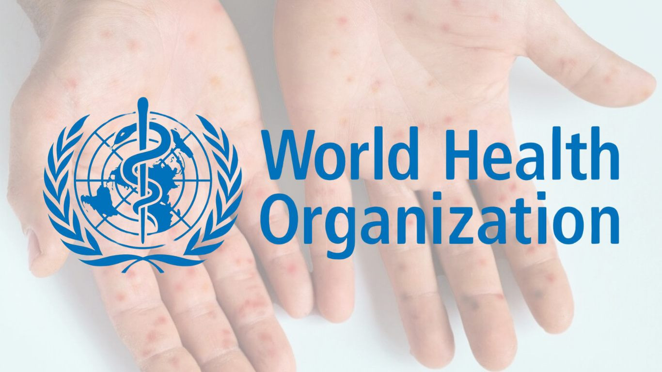 WHO warns more mpox to come in Europe after case in Sweden