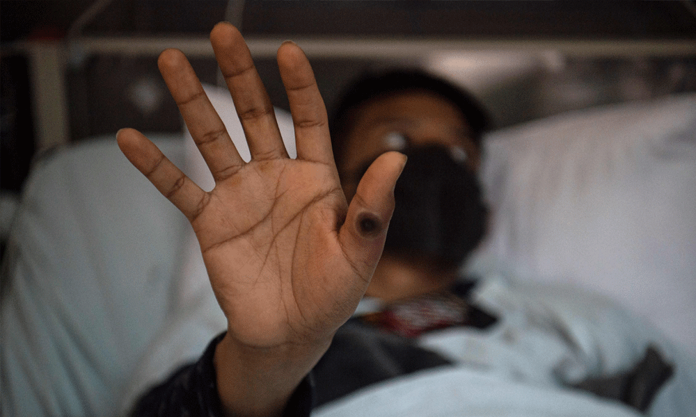 Vigilance at entry points; no cases detected in Bangladesh yet