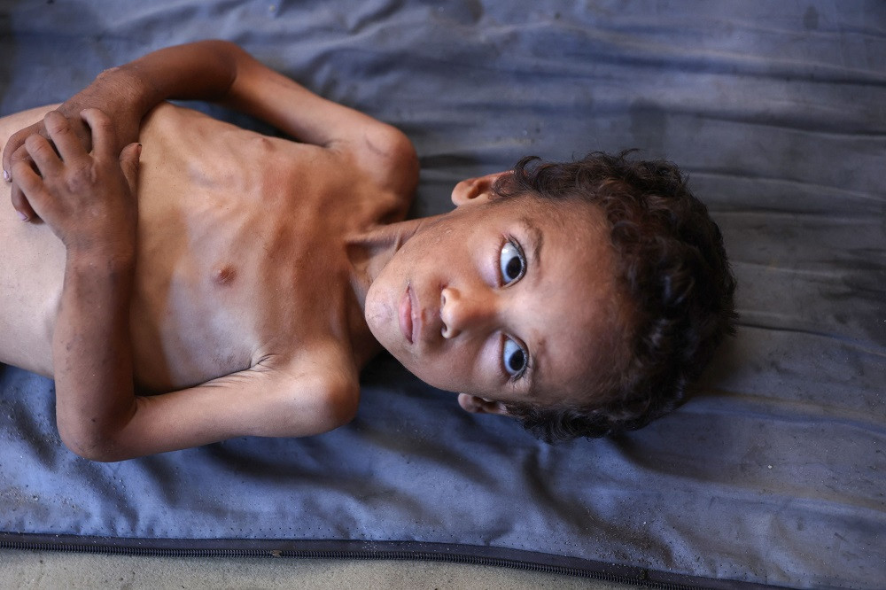 WHO chief joins 111 aid groups to warn about massive Gaza starvation crisis