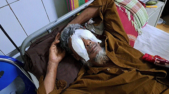 Eye of a man gouged out in Barishal over land dispute