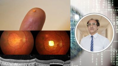 How a British-Bangladeshi surgeon is helping the blind see again