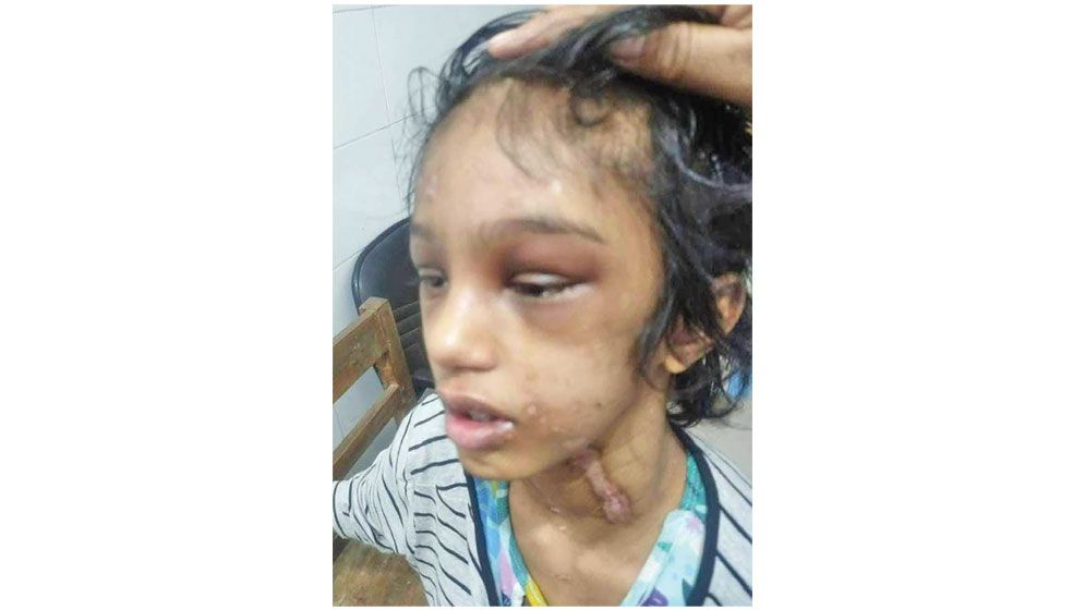 Abused child domestic worker traumatised, needs psychotherapy