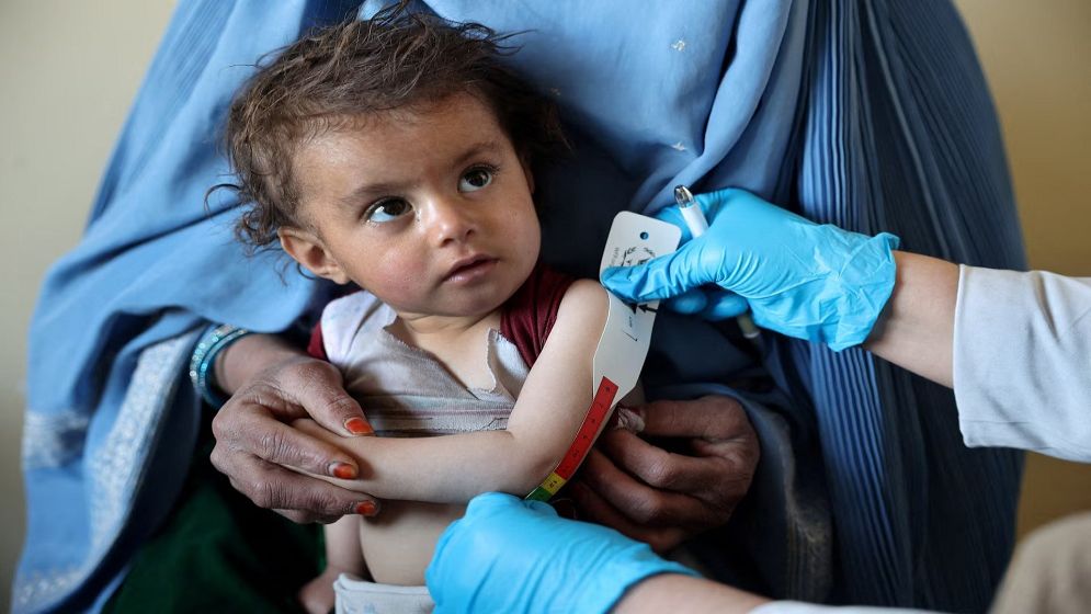 UN warns 200,000 more Afghan children face acute malnutrition in 2026