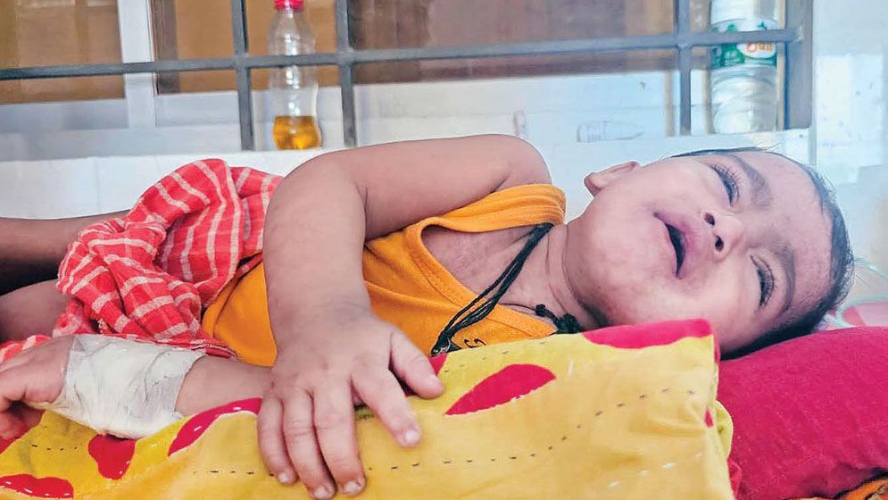 Health officials’ leaves cancelled amid measles outbreak