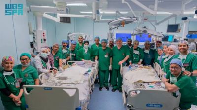 Saudi team successfully separates Filipino conjoined twins after nearly 13 hours
