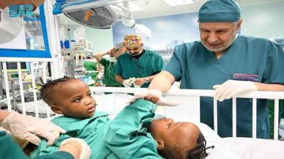 Riyadh doctors successfully complete separation of Tanzanian conjoined twins