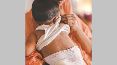 Measles Outbreak Demands Inquiry, not Condolences