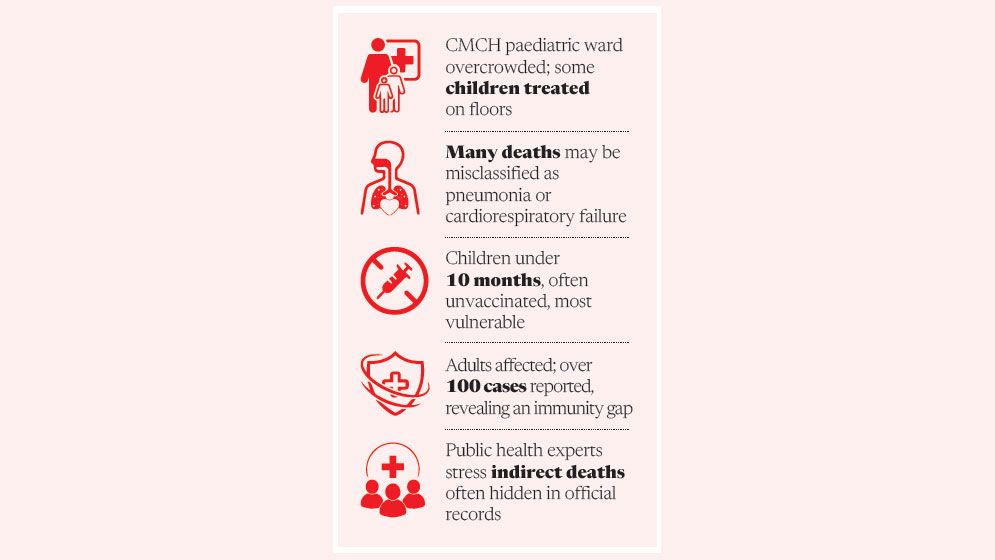 Is real measles toll being hidden in Chattogram?