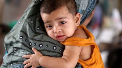 5 children die from suspected measles in 24 hours