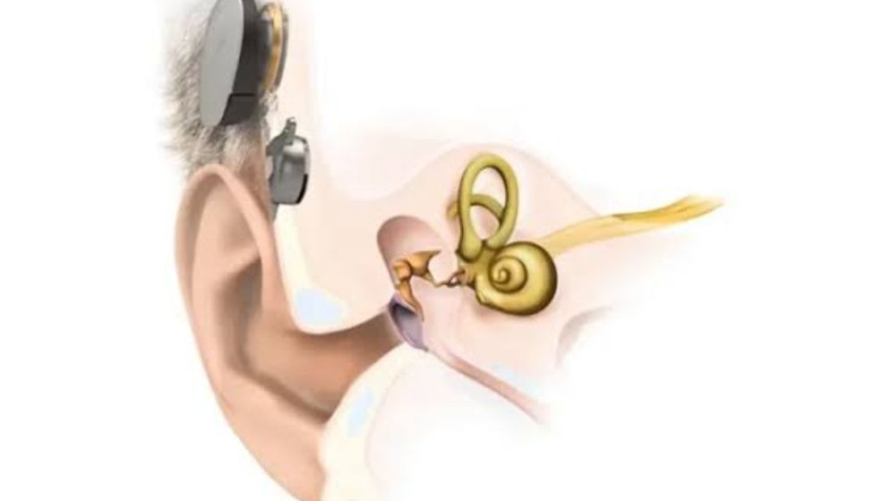 7-yr-old Bangla girl born without ears gets implant at Kolkata city hospital