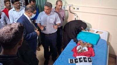 Govt to bear treatment costs of conjoined twins