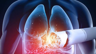Second-hand smoke causes to nearly 1.7M deaths globally: Study